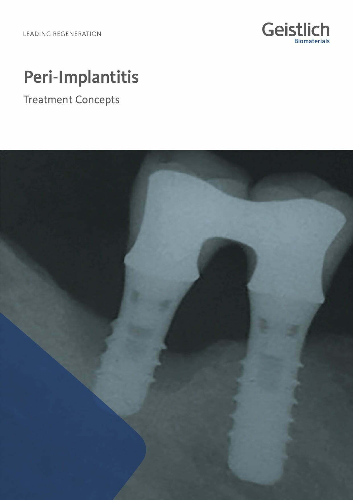 Treatment concepts for peri-implantitis
